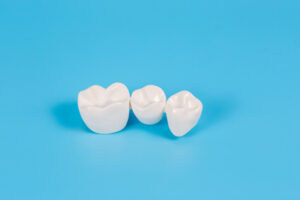 Plastic dental crowns, imitation of a dental prosthesis of a dental bridge for three teeth on a blue background.