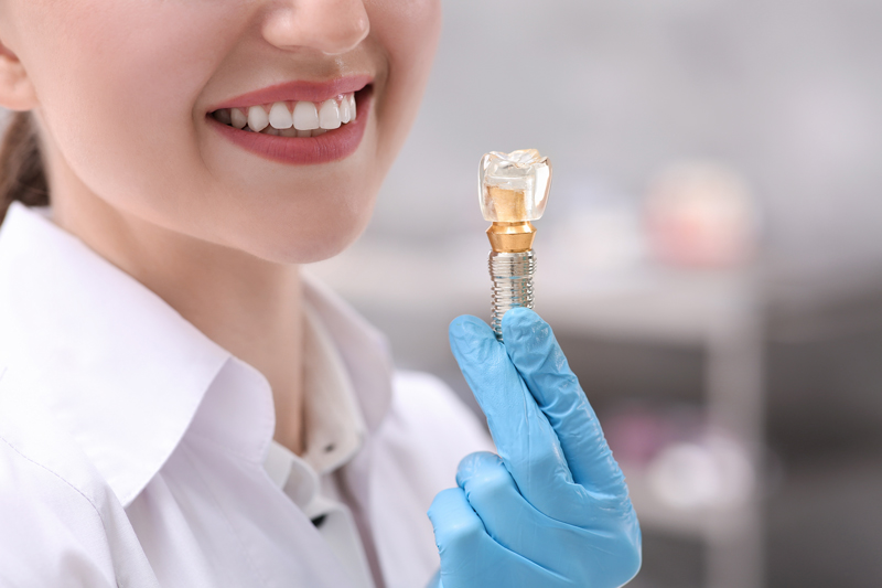 Dentist holding educational model of dental implant indoors, closeup.